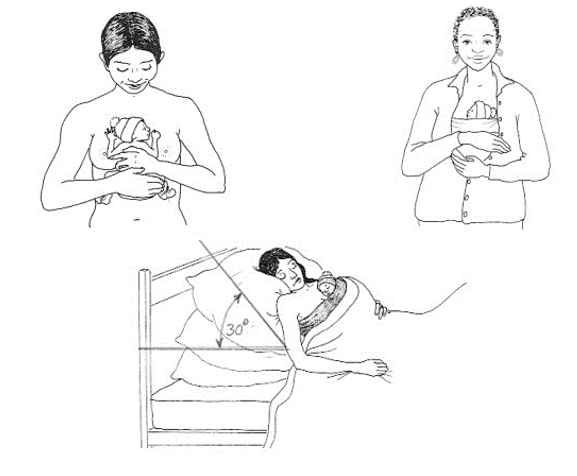 Ilustración 1 Figuras tomadas del “Método madre canguro – guía práctica”, Organización Mundial de la Salud. 2004
